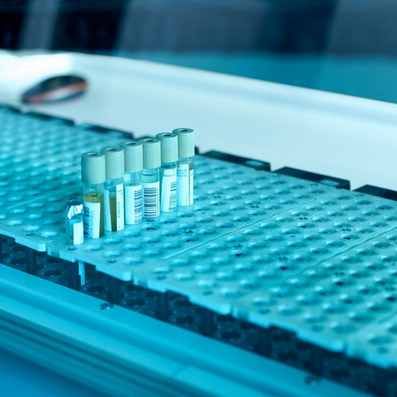 Anti-Drug Antibodies: Clinical Implications and the Importance of Robust Immunogenicity Testing
