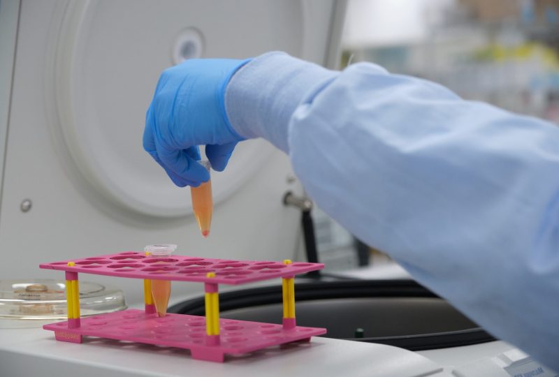 PBMC and Laboratory Services